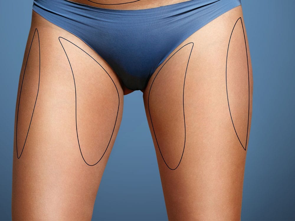 PERDRE SA CULOTTE DE CHEVAL, POSSIBLE ?